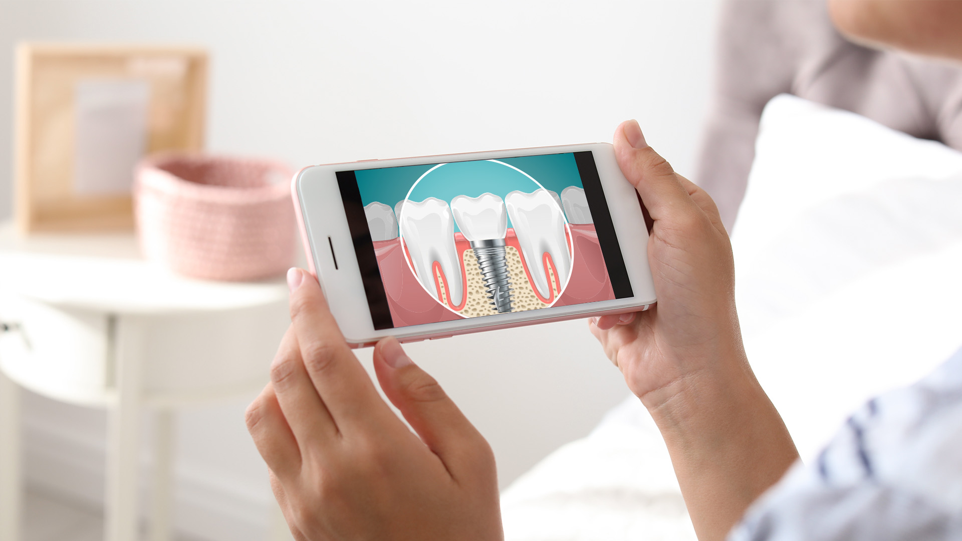 An illustration showing a smartphone displaying an image of a tooth with a magnified view of its root and surrounding tissues, highlighting dental health concerns.
