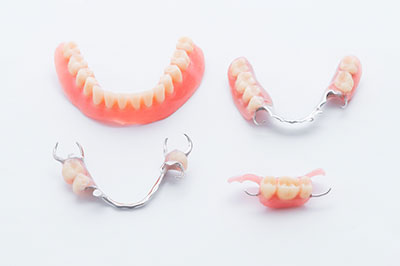 The image shows a collection of dental appliances, including braces and teeth aligners, displayed against a white background.