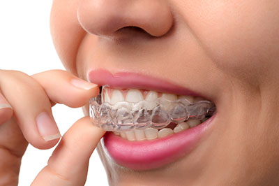 An adult woman with a wide smile, holding her finger near her mouth, which is filled with clear braces.