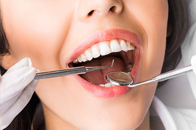 The image shows a close-up of a woman with a large smile, wearing white gloves and holding a dental instrument near her mouth.