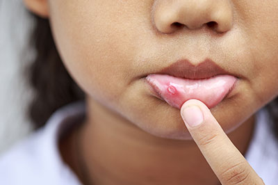 A young girl with her finger on her lips, looking at the camera.