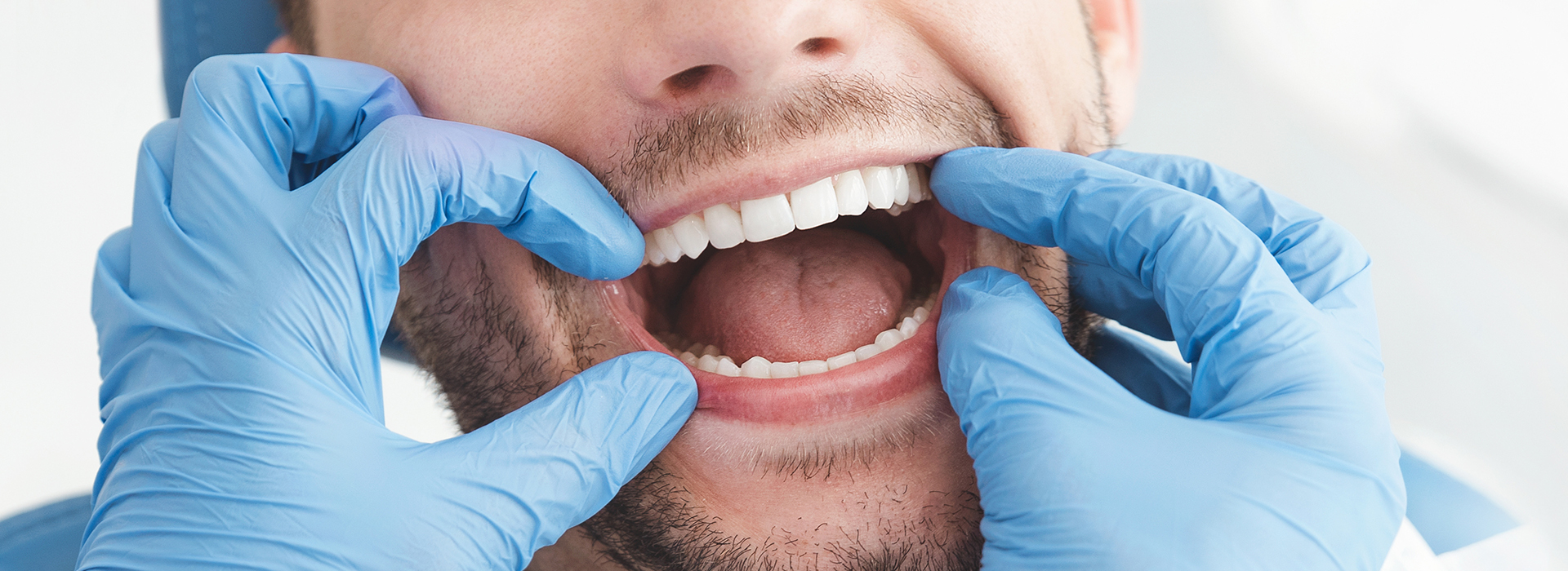 A man with his mouth wide open, being held by blue gloved hands, possibly in a dental or medical setting.